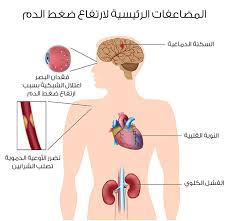 العلاج السريع في حال ارتفاع الضغط 20160820 102 1