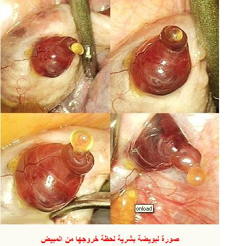 معرفة الحمل بعد 4 ايام من تلقيح البويضة 20160629 79