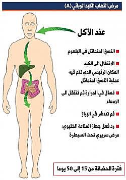 مرض الكبد 20160720 330