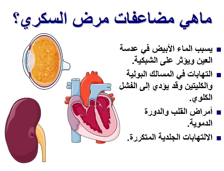 اعراضه مرض السكري، ومضاعفاته 20160723 980