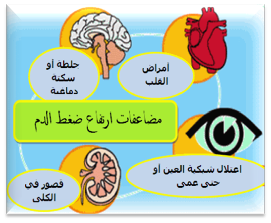 اعراض ضغط الدم 21837