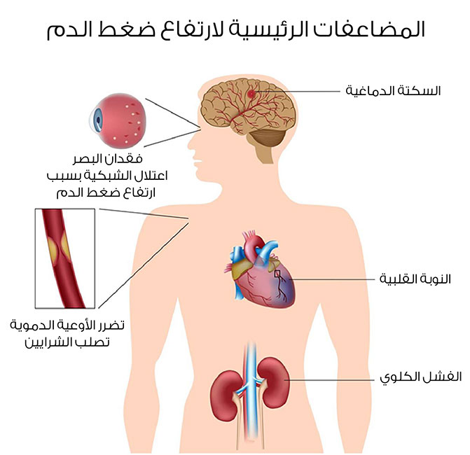 اعراض وعلامات وعلاج ضغط الدم