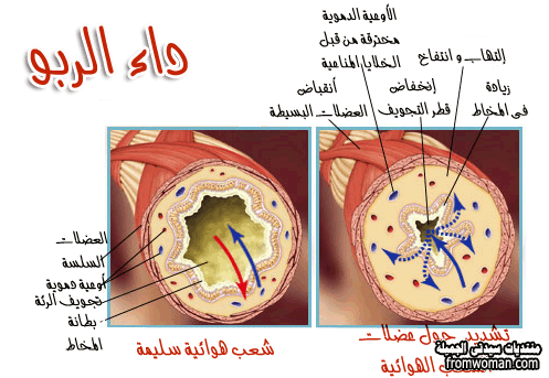 علاج مرض الربو بالطب البديل 20160719 186