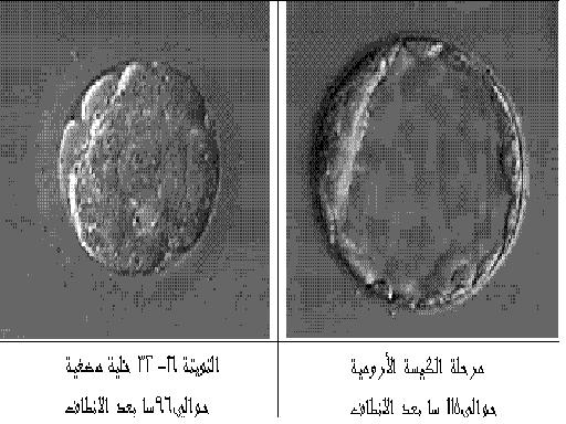 معرفة الحمل بعد 4 ايام من تلقيح البويضة 20160629 80