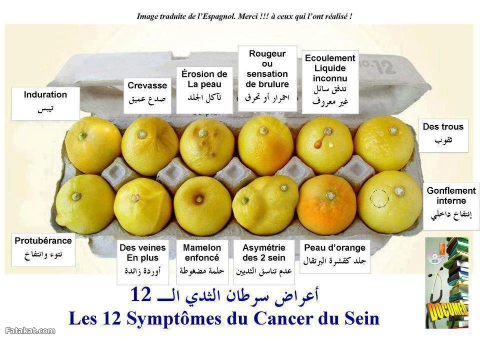 من اعراض مرض سرطان الثدي