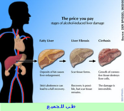 خمر فوائد ماهي فوائد الخمر