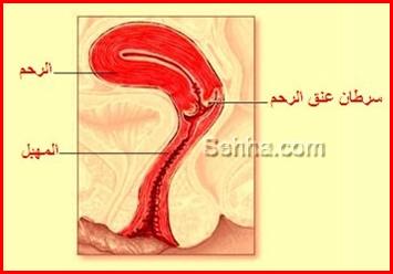 سرطان عنق الرحم F089151D3D9F327D8C2B405524B9714F