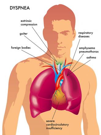اختناق و ضيق فى التنفس 24798 3