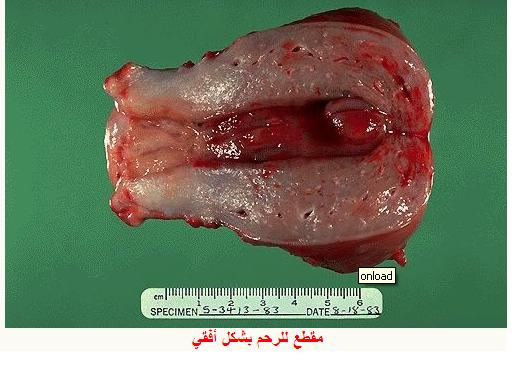 كيف يحدث الحمل عند النساء شرح مصور لعمليه تلقيح البويضه