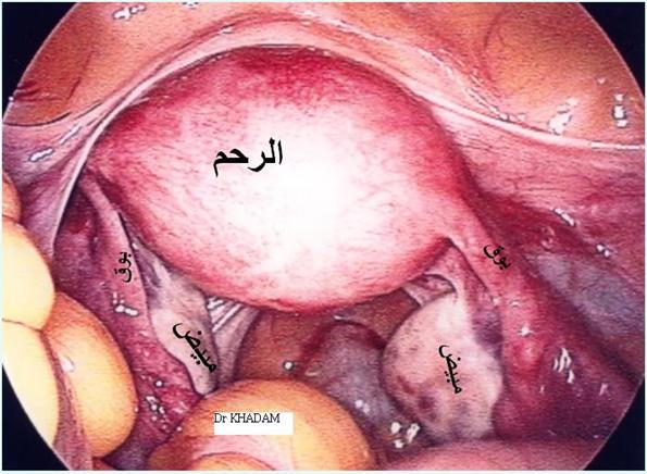 كيف يحدث الحمل عند النساء شرح مصور لعمليه تلقيح البويضه