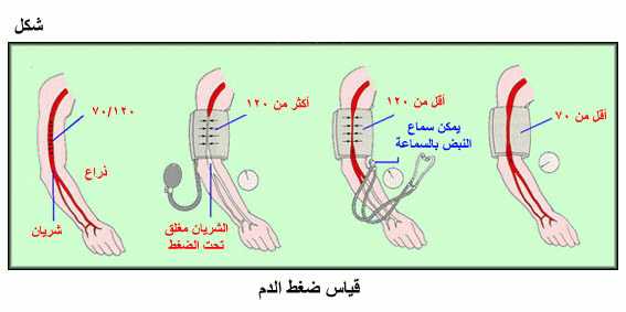 اعراض ارتفاع ضغط الدم - اعراض الضغط 9Ef50868675Feef36454902B8B96718D