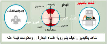 هل يمكن رؤية غشاء بكارة بالعين ام لا ، معلومات للفتيات هامة جدا Unnamed File 44