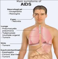 اعراض مرض الايدز عند الرجال