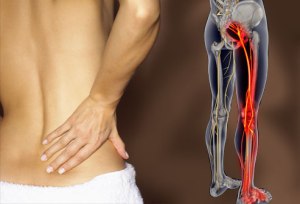 Sciatica-_Lower_Back_Pain