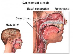 symptoms-of-cold