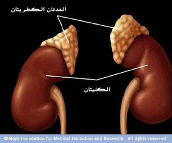 طريقة لعلاج المغض الكلوى