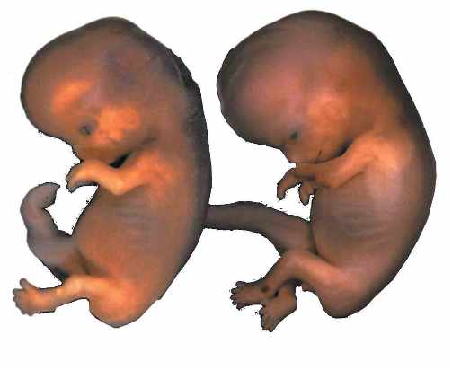 12414 10 مراحل الحمل - تطور الجنين فبطن امه حلمي جميل