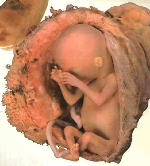 12414 11 مراحل الحمل - تطور الجنين فبطن امه حلمي جميل