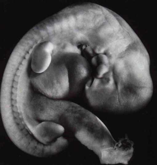 12414 4 مراحل الحمل - تطور الجنين فبطن امه حلمي جميل