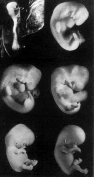 12414 8 مراحل الحمل - تطور الجنين فبطن امه حلمي جميل
